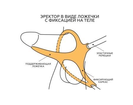 "Ложечка" - эректор MEN Style